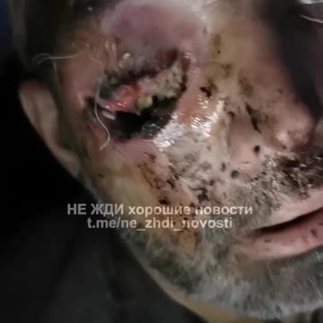 Commander Refusing to Allow Russian Soldier to Evacuate