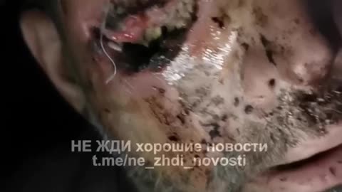 Commander Refusing to Allow Russian Soldier to Evacuate