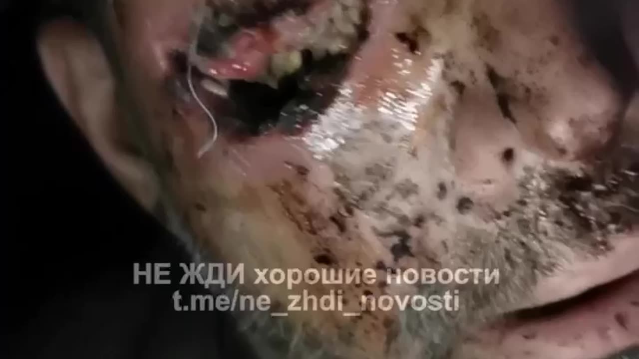 Commander Refusing to Allow Russian Soldier to Evacuate