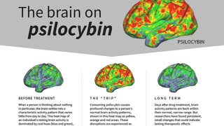 MAGIC MUSHROOM COMPOUND "RESETS" BRAIN