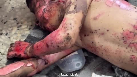 10 martyrs, including children and women, arrived at Al-Shifa Hospital