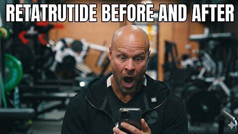 Retatrutide Before & After