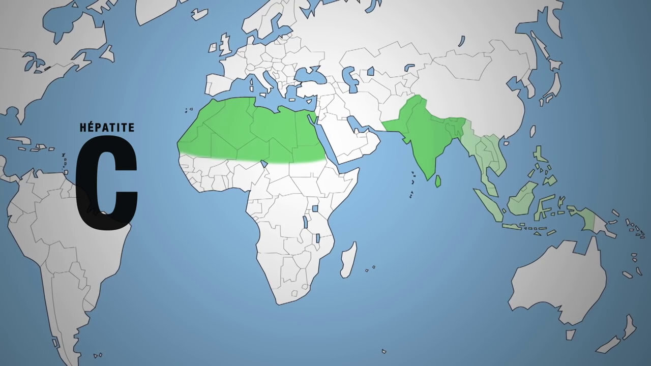 Grandes tueuses : Les hépatites | Inserm [Flokossama]
