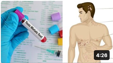 "8 Indicators of Potentially Harmful Heavy Metal Accumulation in Your Body"
