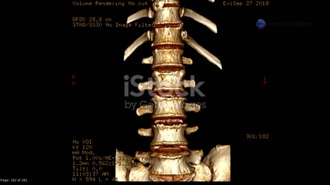 JESUS-THE BACKBONE OF OUR LIVES!