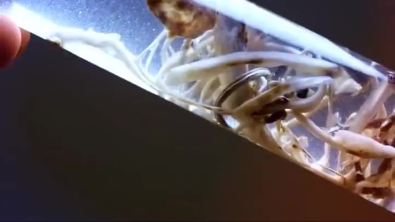 HORRIFIC FINDINGS IN CORPSES - THE GENE 🧬 THERAPY