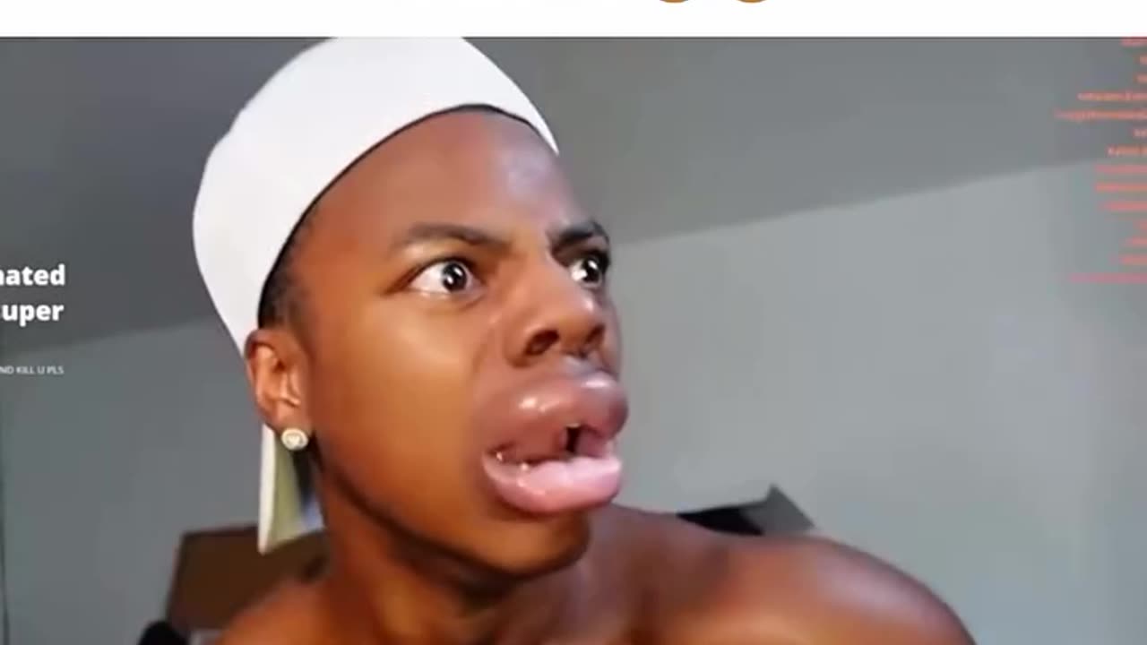 Ishowspeed does the kylie lip challenge | gone wrongðŸ˜