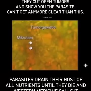 CANCER is parasites?