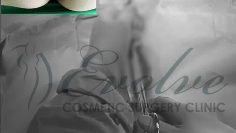 Uterine Prolapse Surgery Explained | Laparoscopic & Vaginal Repair for Postmenopausal Women