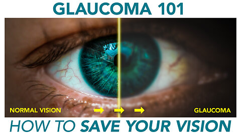 How Glaucoma Steals Your Vision