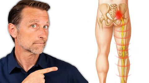 STOP Sciatica & Back Pain FAST - Dr. Berg Explains