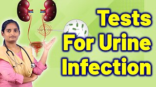 What are the Test for Urine Infection? | Bladder Infection Treatment | Homeopathy, Medicine Cure