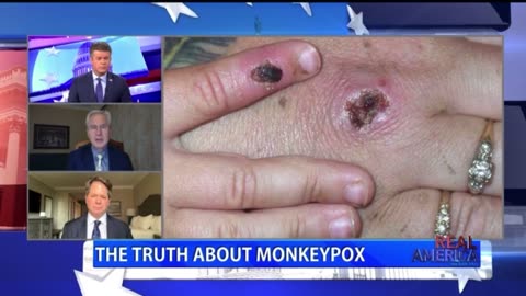 Dr. McCullough and John Leake Dispel Monkeypox Myths on Dan Ball's Real America