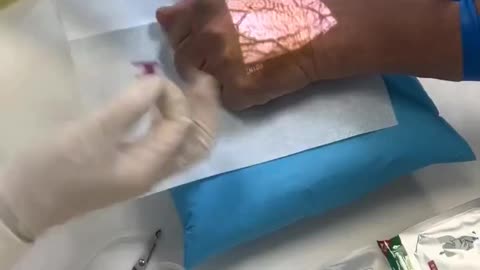 Using a vein finder to ensure accurate and comfortable injections