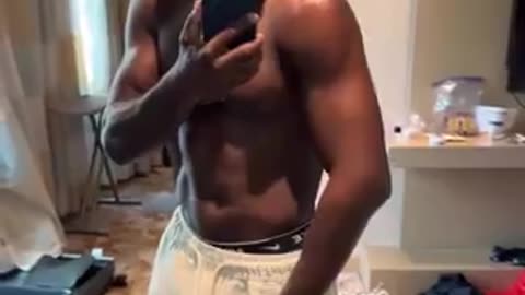 Aljamain Sterling shows his swollen arm after landing a spinning back elbow on Brian Ortega.