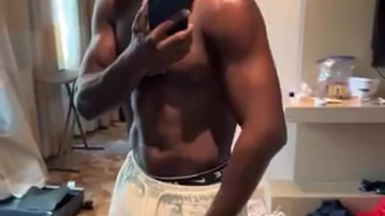 Aljamain Sterling shows his swollen arm after landing a spinning back elbow on Brian Ortega.