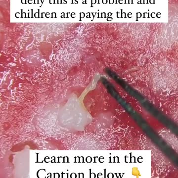 Nobodies ever really paid much attention to Parasites until...