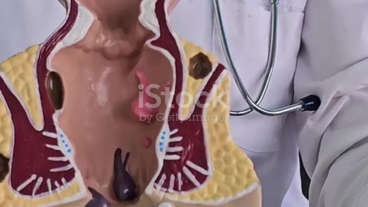 Abortion Pill: All the Information You Need to Understand Medication Abortion