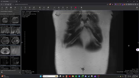 TIC Health Abdomen & Pelvis MRI Scan Images
