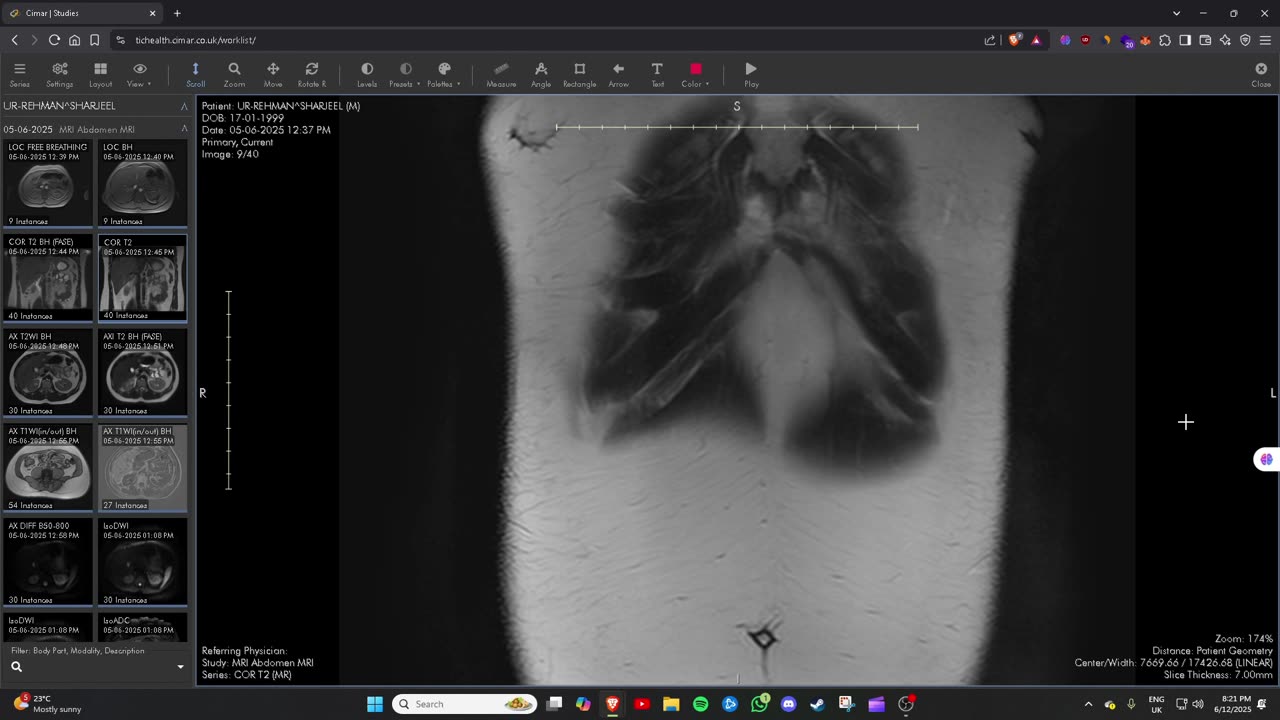 TIC Health Abdomen & Pelvis MRI Scan Images