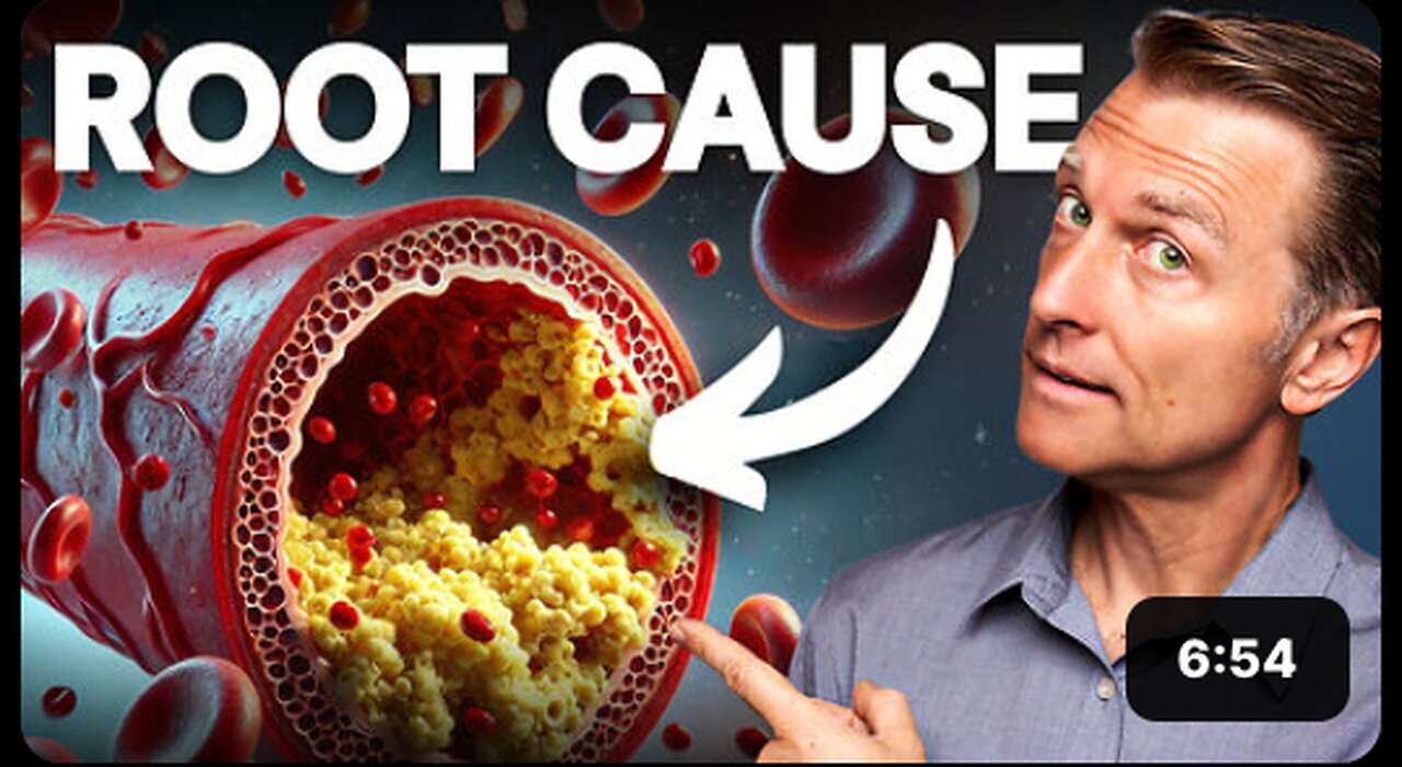 "Discover the Top Heart-Healthy Meal for Unblocking and Cleaning Your Arteries"