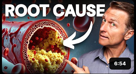 "Discover the Top Heart-Healthy Meal for Unblocking and Cleaning Your Arteries"