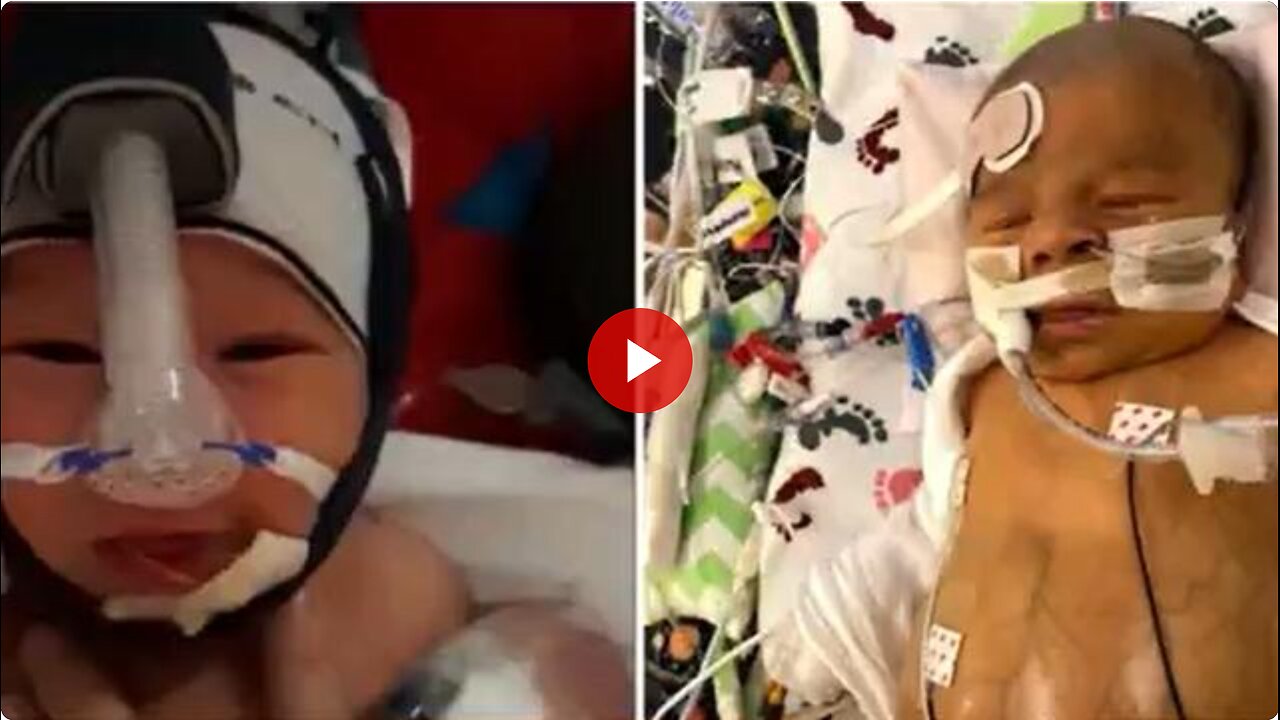 Baby Has Died of Blood Clot after Vaccinated Blood Transfusion - Against Parents Wishes