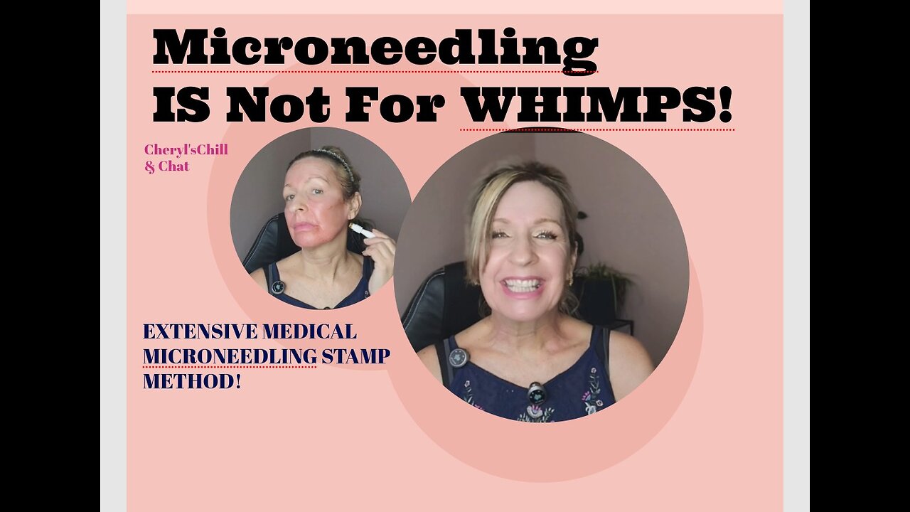 Microneedling Is Not For The Weak!