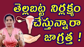 తెల్లబట్ట సమస్యలు జాగ్రత్తలు | Precautions For White Discharge Homeopathy Treatment Medicine Cure
