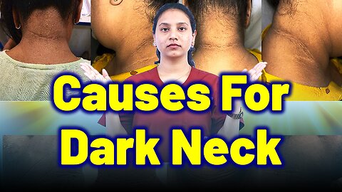 Dark Underarms & Neck: Causes You Must Not Ignore | Treatment Cure Medicine Surgery | Gynaecology