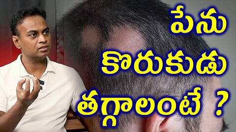 పేను కొరుకుడు తగ్గాలంటే? Alopecia Areata or Spot Baldness Homeopathy Treatment Cure Medicine
