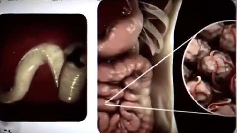 PARASITES, DEMONS & VIBRATIONS - THE TRUTH ABOUT PARASITES 💣