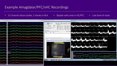 Advancements in Wireless Technology for Single Unit Electrophysiology Recording Neuralynx