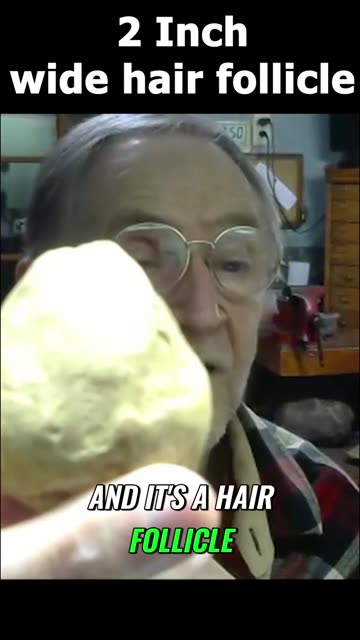 Petrified GIANT Hair Follicle.