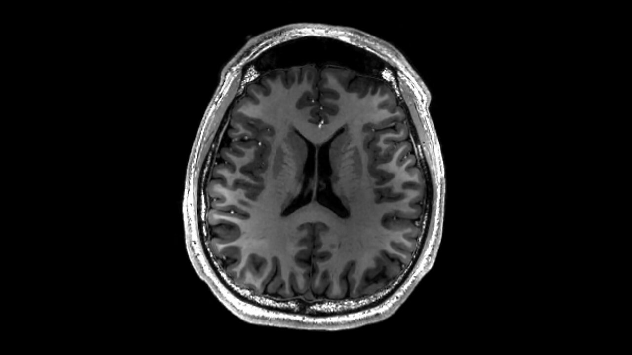 The MYTH of the Teen Brain