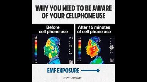 Radiation Right into Your Brain