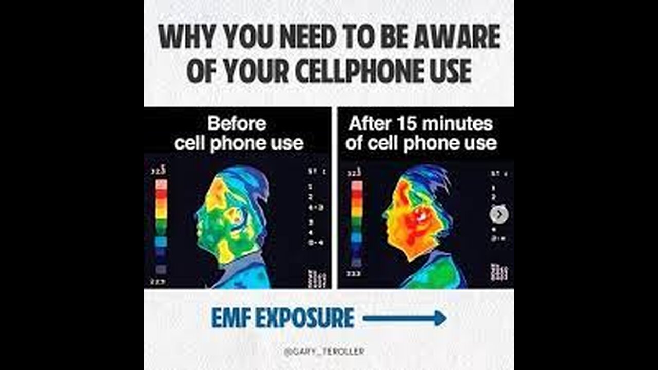 Radiation Right into Your Brain