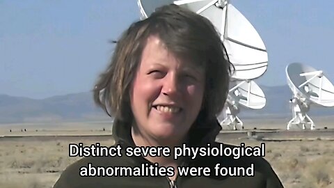 "Very Very Severe" Myalgic Encephalomyelitis (M.E.) vs Chronic Fatigue Syndromes (aka SEID and erroneously known as "ME/CFS") by Lisa Petrison