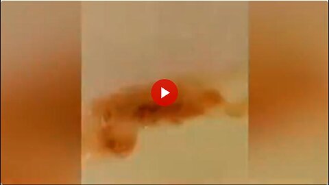 "Organoids "Jab victim discharging biological creatures woman reports horror after Moderna shot