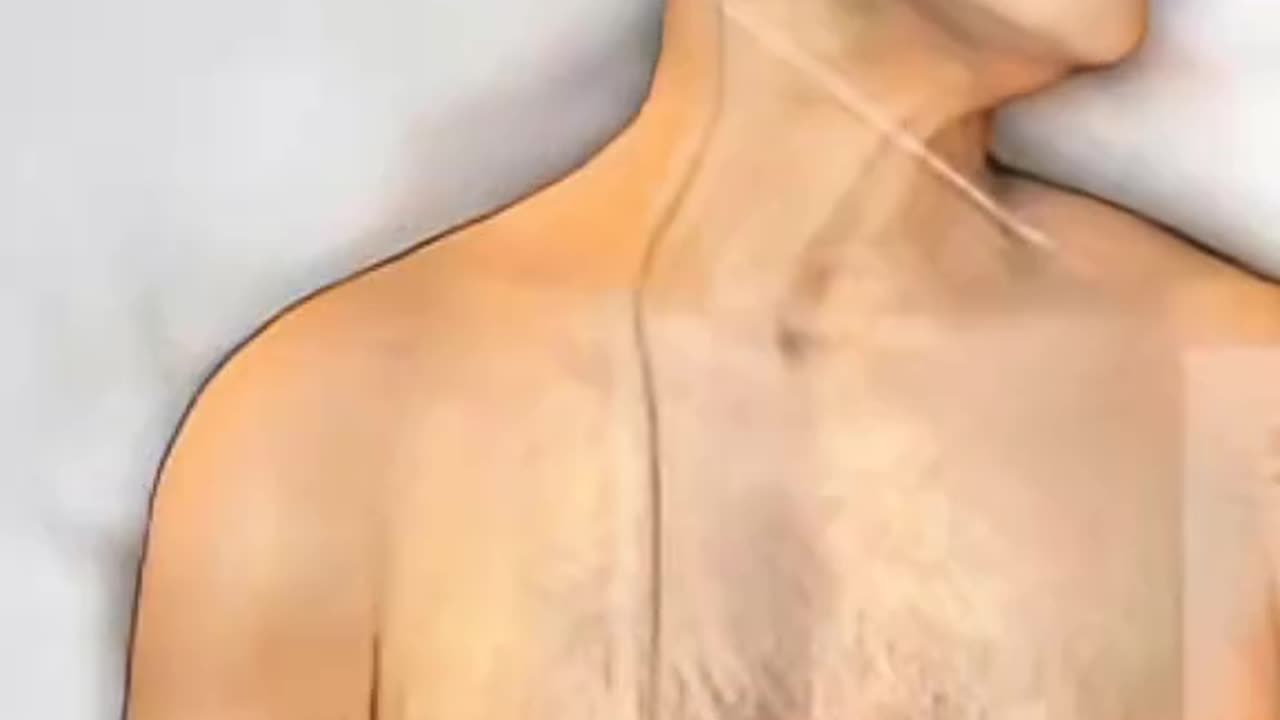 How Surgeons Remove Brain Fluid to Save Lives