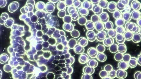 Live Blood Analysis Intro