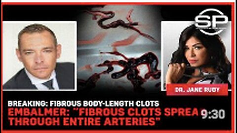 "Embalmer Reports Fibrous Clots Spreading Through Entire Arteries"