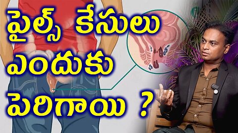 పైల్స్ కేసులు ఎందుకు పెరిగాయి? Why Piles come and What's the solution? Homeopathy Cure Medicine