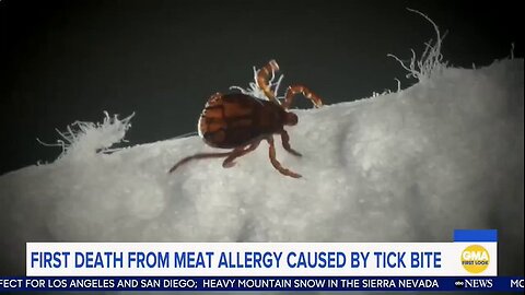 Man dies after a tick bite triggers a meat allergy