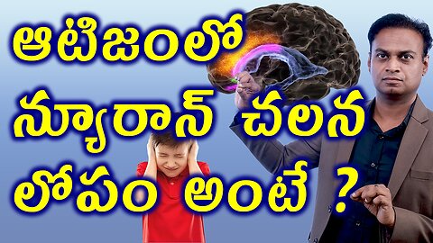 ఆటిజంలో న్యూరాన్ చలన లోపం అంటే? Brain Neurons Migration Defect in Autism Spectrum Disorder ASD Cure