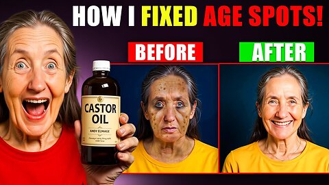 I ELIMINATED 10 Years of Age Spots Using Castor Oil! Here's My Method! E08