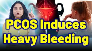 Why PCOS Causes Heavy Periods, Endometrial Hyperplasia, Irregular Bleeding? | Treatment & Cure |