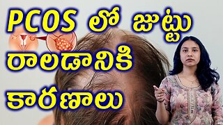PCOS లో జుట్టు రాలడానికి కారణాలు Main Causes for Hair fall in PCOS Homeopathy Treatment Cure Clinic