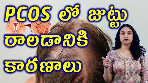PCOS లో జుట్టు రాలడానికి కారణాలు Main Causes for Hair fall in PCOS Homeopathy Treatment Cure Clinic