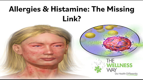 Allergies and Histamines: The Missing Link PART 1